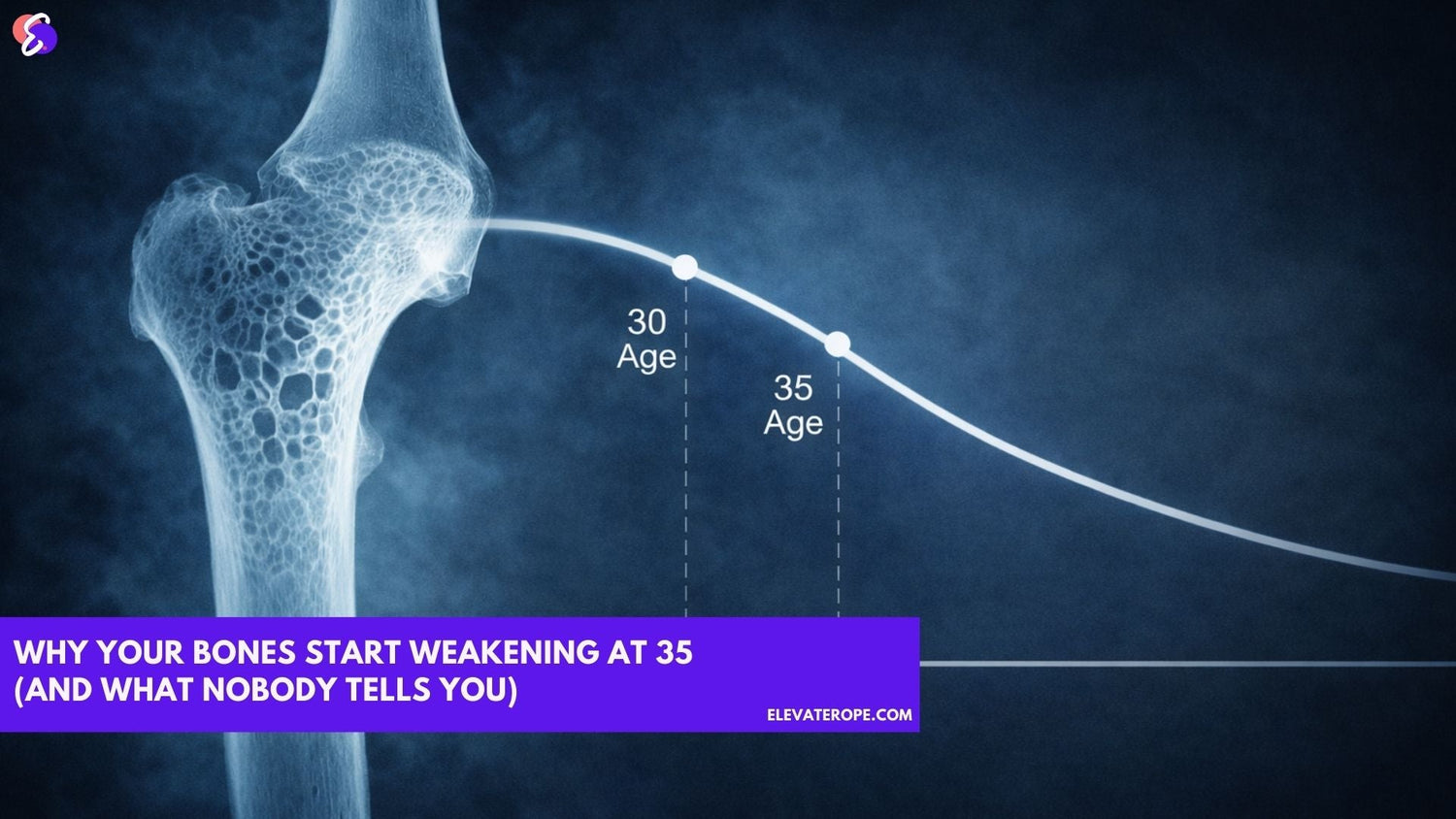Medical illustration of femur showing bone loss at age 35 with graph of peak bone mass at 30 and gradual bone density decline.